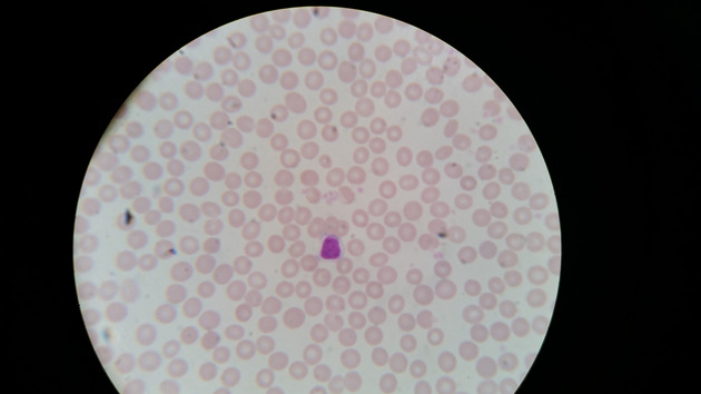 Blood Slides - Blood 001 400X